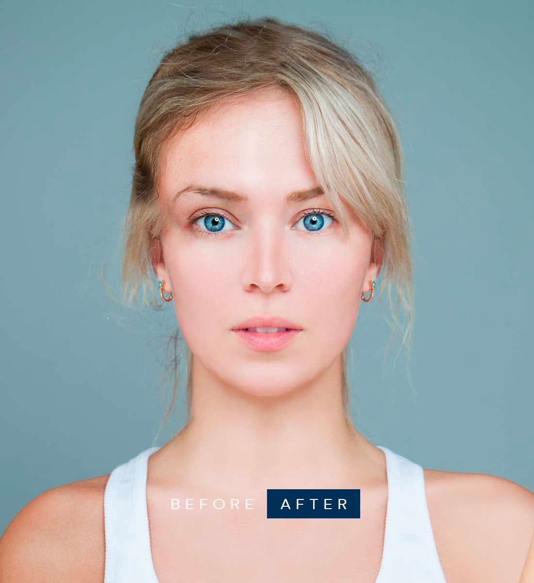 Body Transformation - After