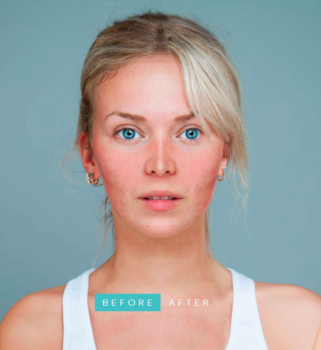 Body Transformation - Before