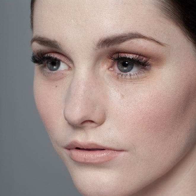 Facial Transformation - Before